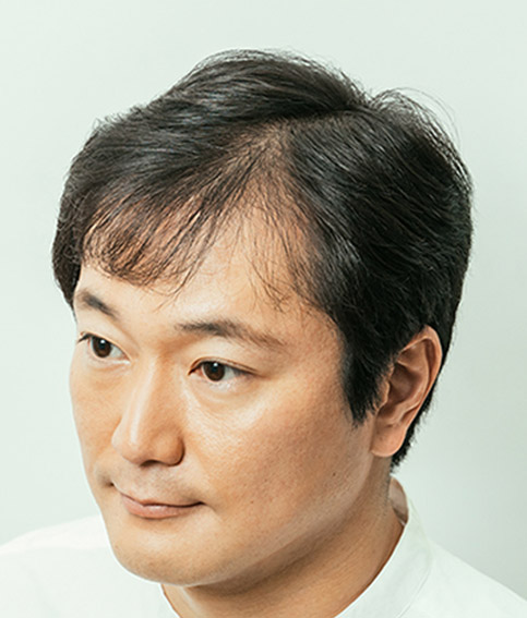 未増毛